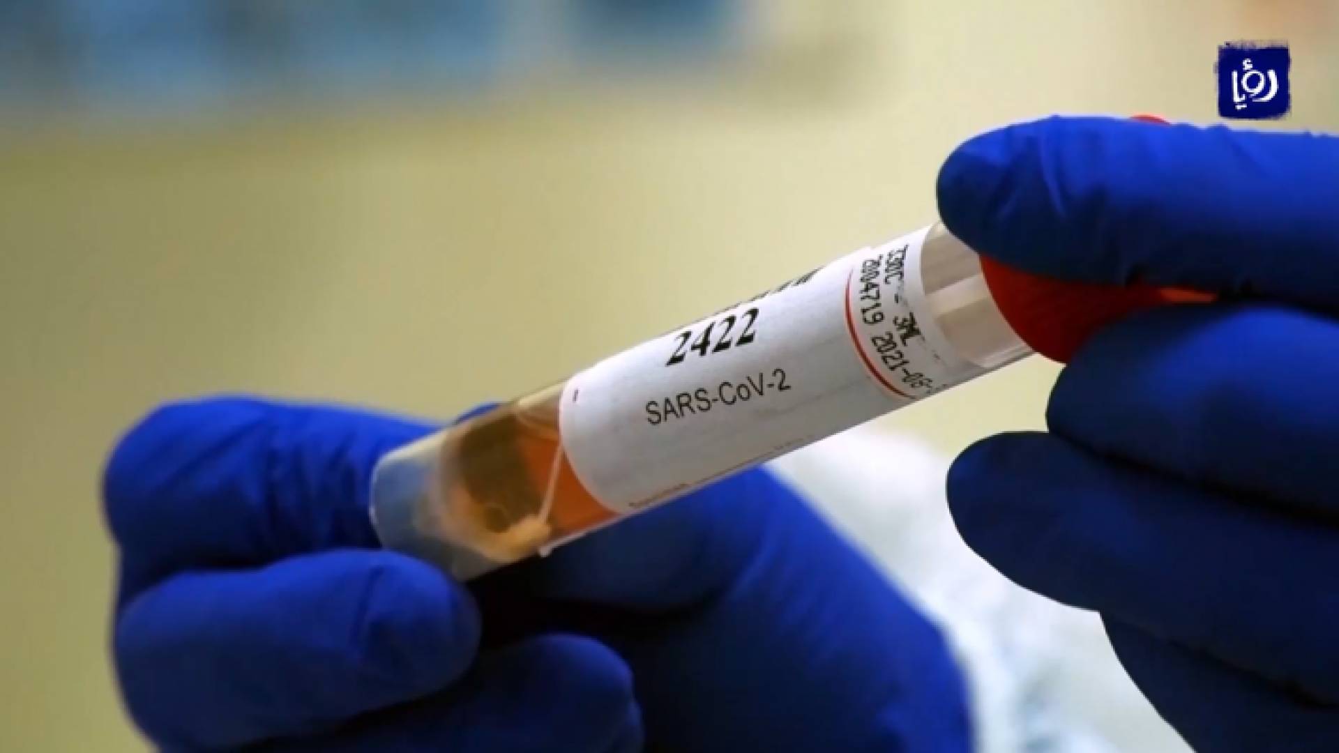 عينة فحص كورونا