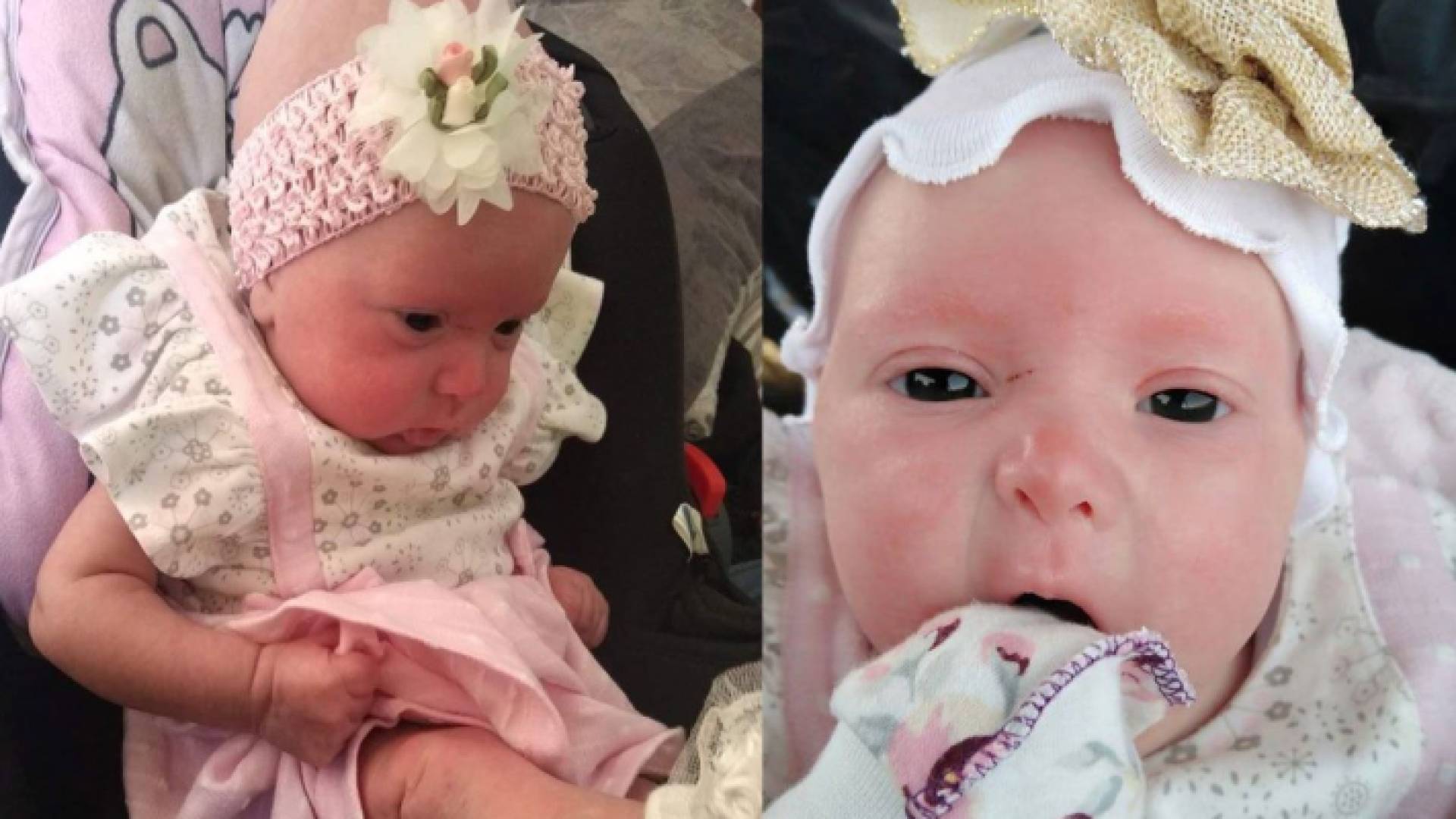 الطفلة تعاني من نقص مناعة خلقي شديد