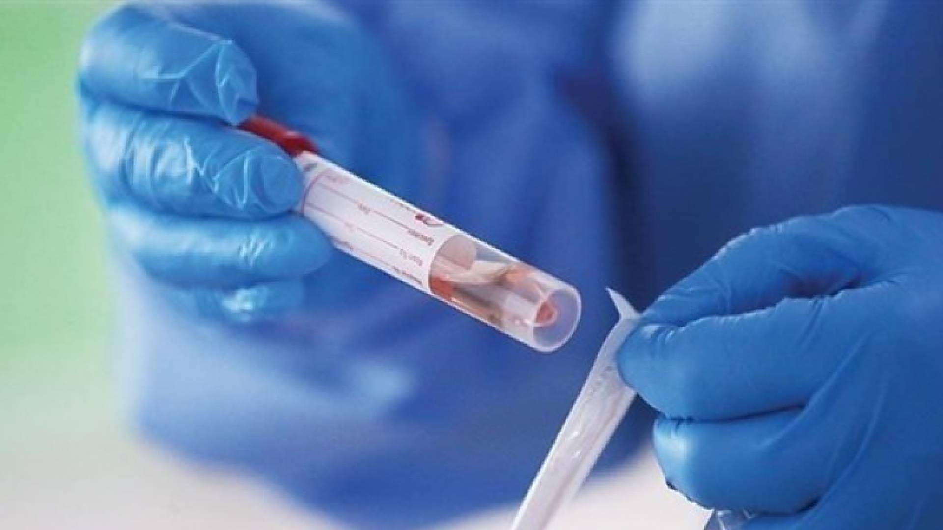 روسيا تحاول سرقة معلومات تتعلق بتطوير لقاح للفيروس