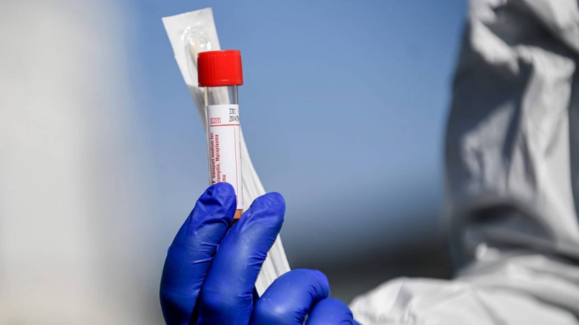 عينة فحص كورونا