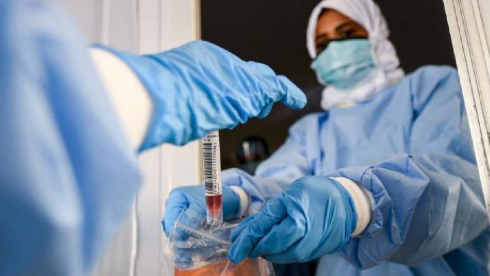 وفاة و390 إصابة جديدة بكورونا في الإمارات