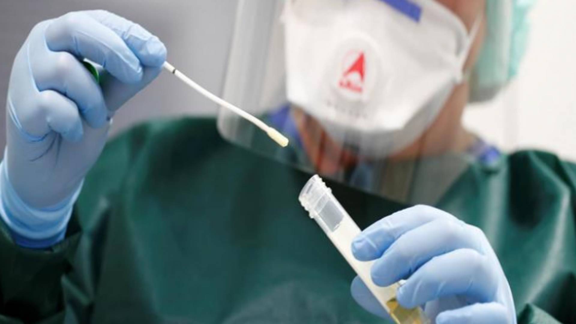 ارشيفية لمسحة كورونا