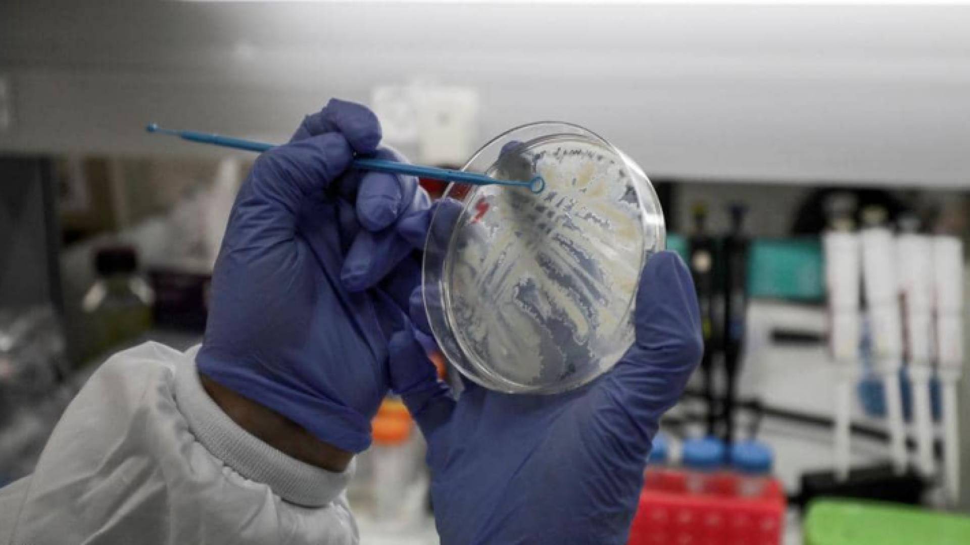 عدة تجارب تقوم بإجراء اللقاح ضد فيروس كورونا