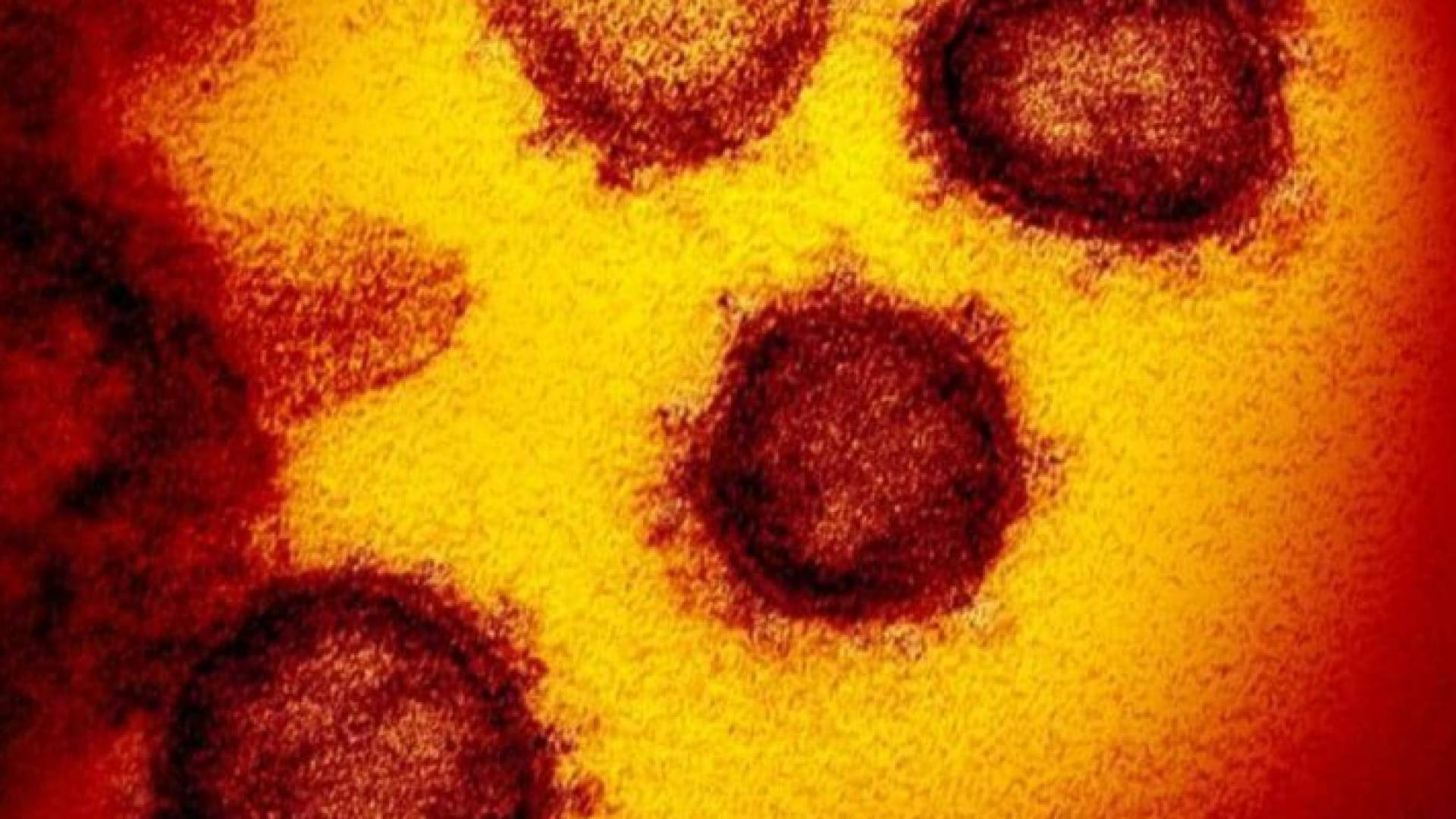 صورة مجهرية لفيروس كورونا