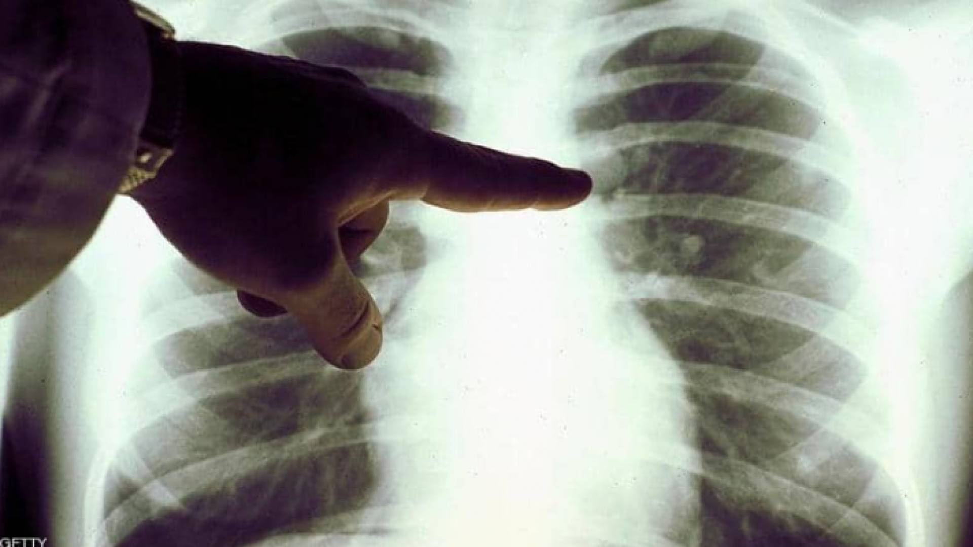 الصورة أرشيفية