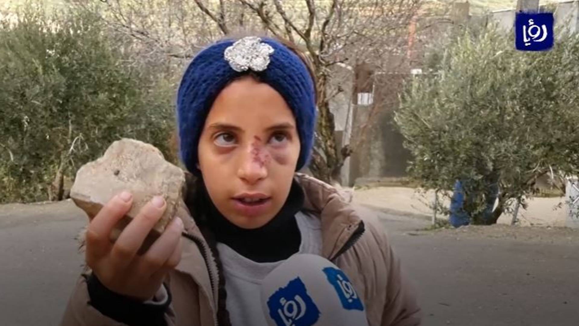 الطفلة الفلسطينية حلا