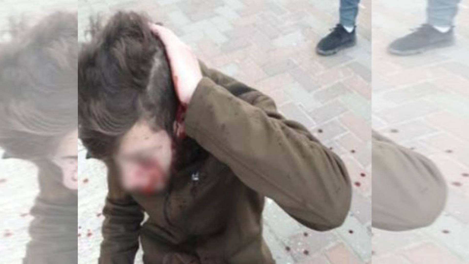 مستوطنون يعتدون على فتى فلسطيني ويصيبونه بجرح في رأسه