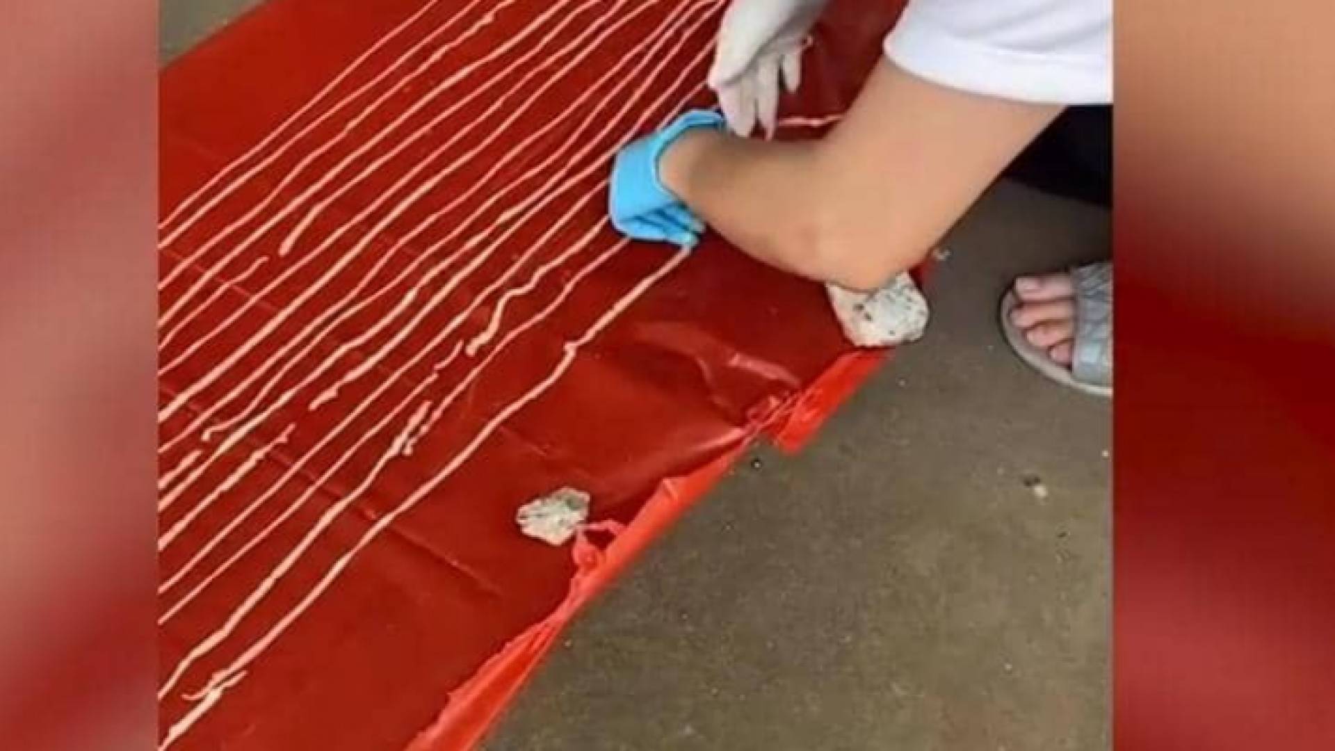 الدودة العملاقة التي تم استخراجها من بطن المريض