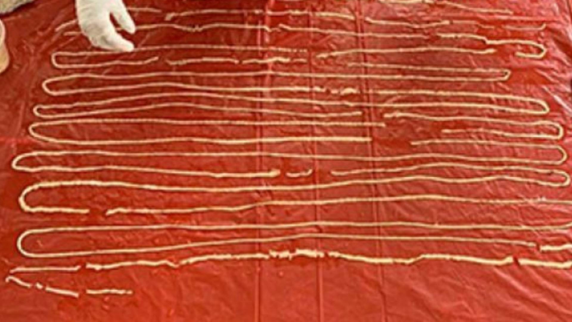 طول الدودة 18 مترا