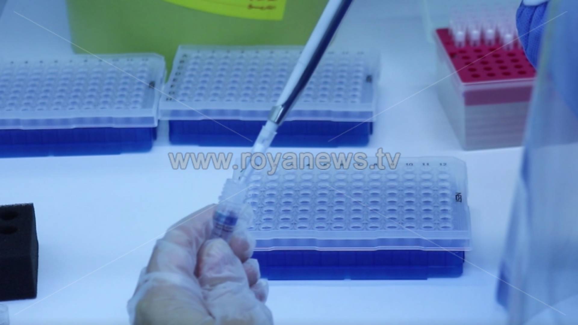 عينة لفحص الإصابة بفيروس كورونا