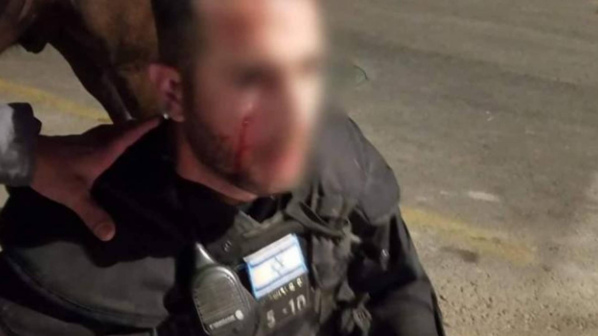 الجندي الاسرائيلي المصاب