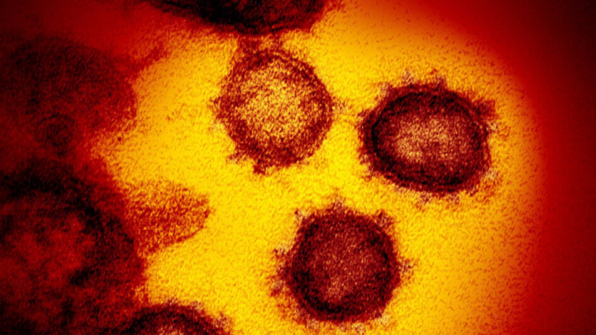 الصورة تعبيرية