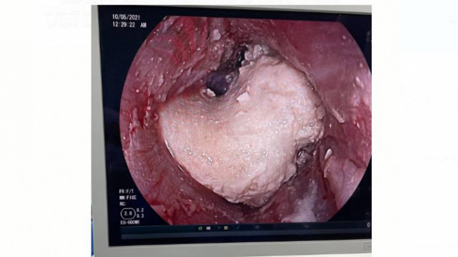 صورة من العملية
