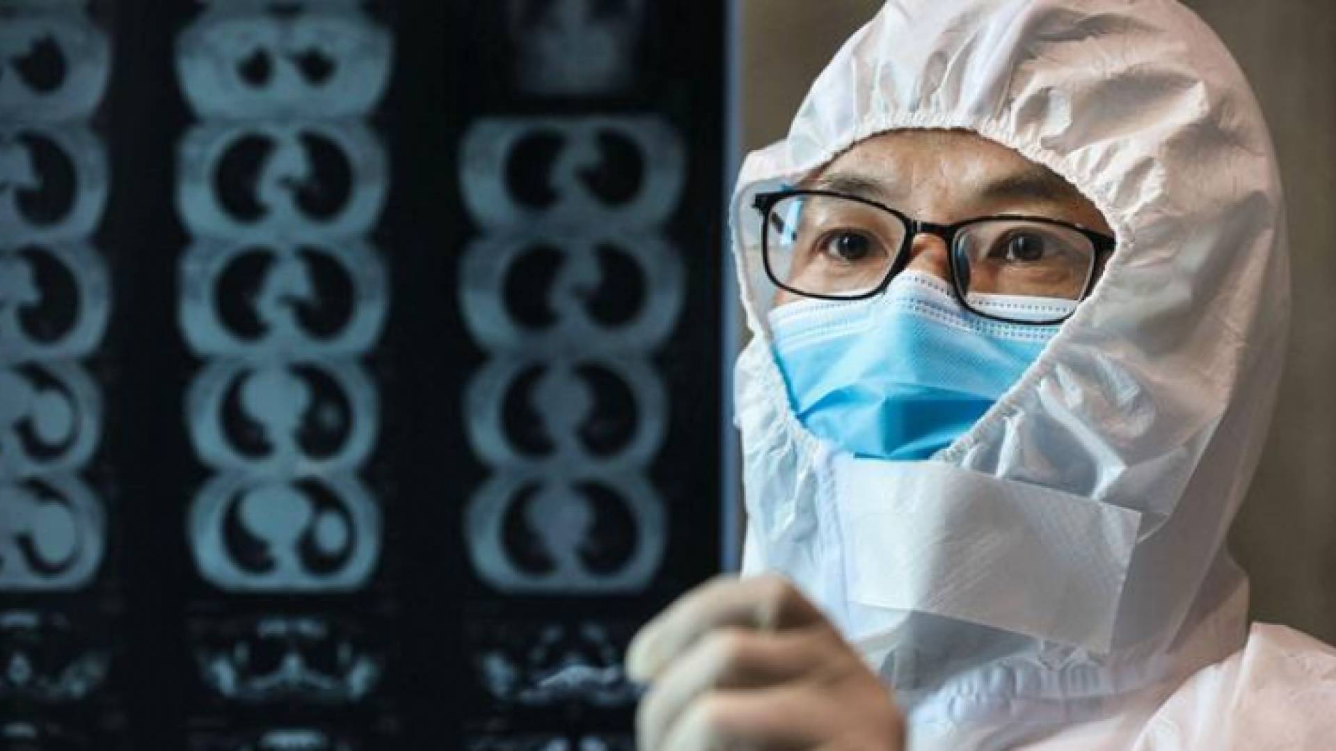 البيت الأبيض يطالب بتحقيق "غير مسيس" في منشأ كورونا