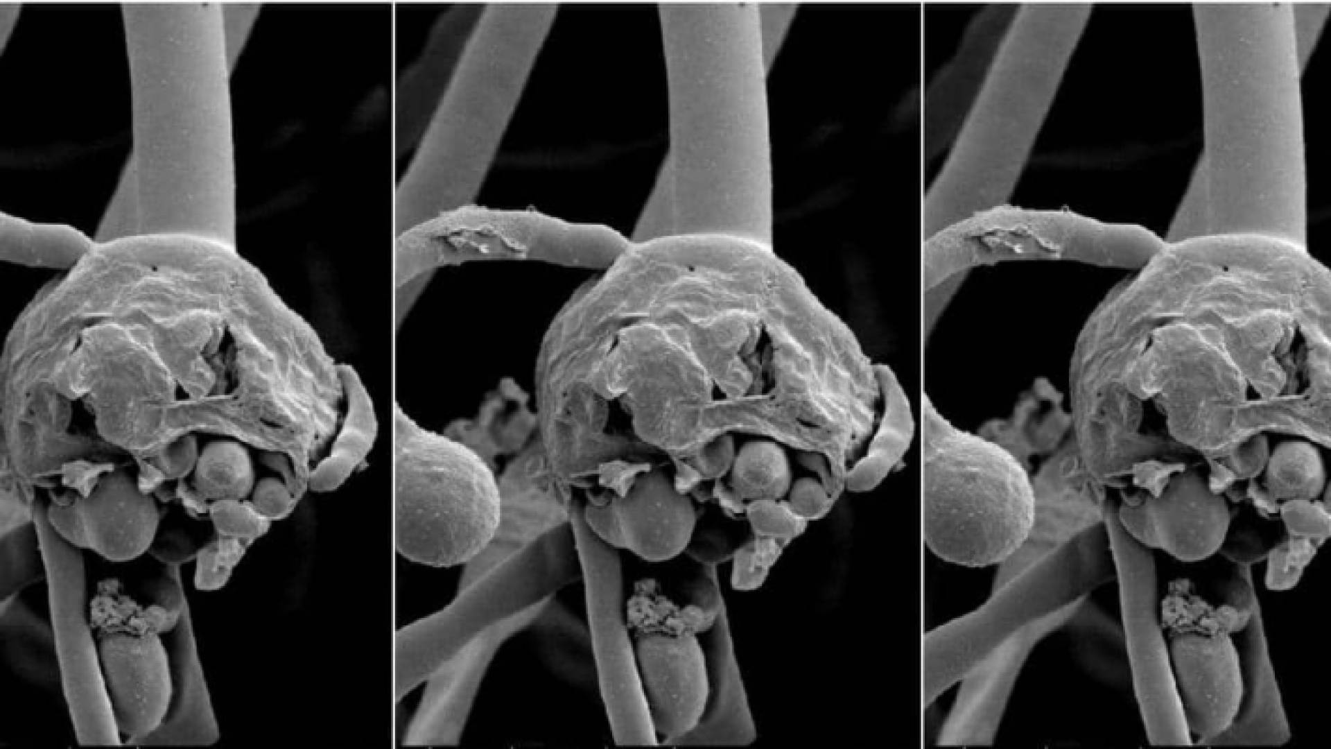 تصوير بالأشعة يظهر عقد الفطر الأسود لدى أحد المصابين