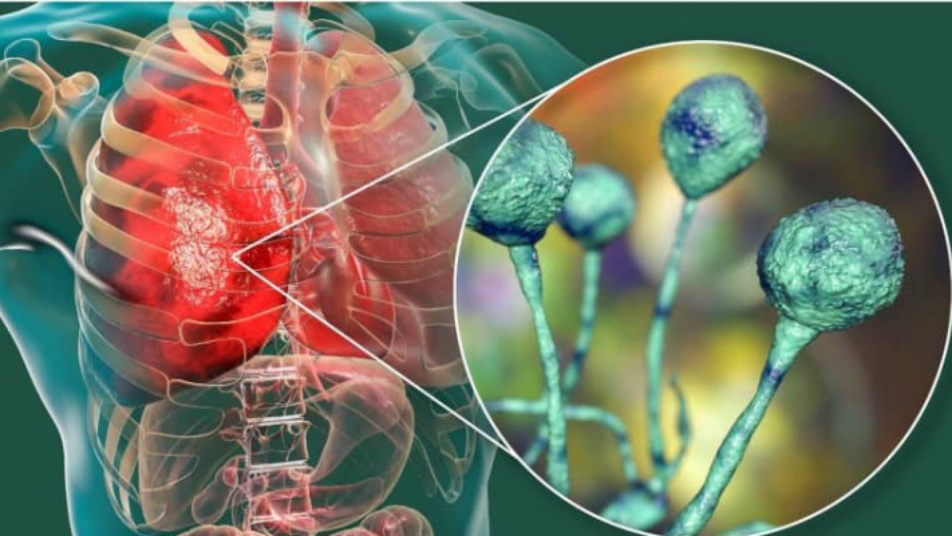 الصورة تعبيرية