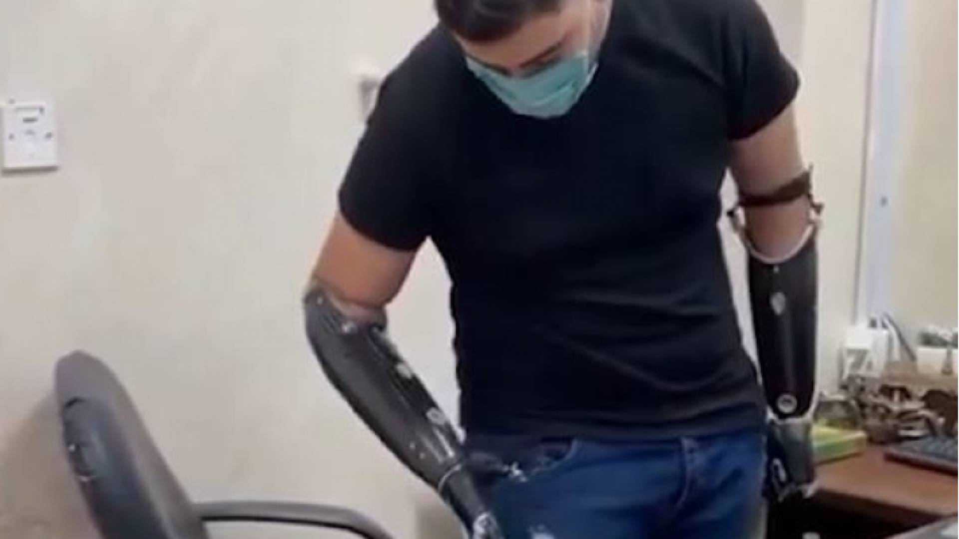 تى الزرقاء صالح يمارس يومياته بعد تركيب يديه الاصطناعيتين