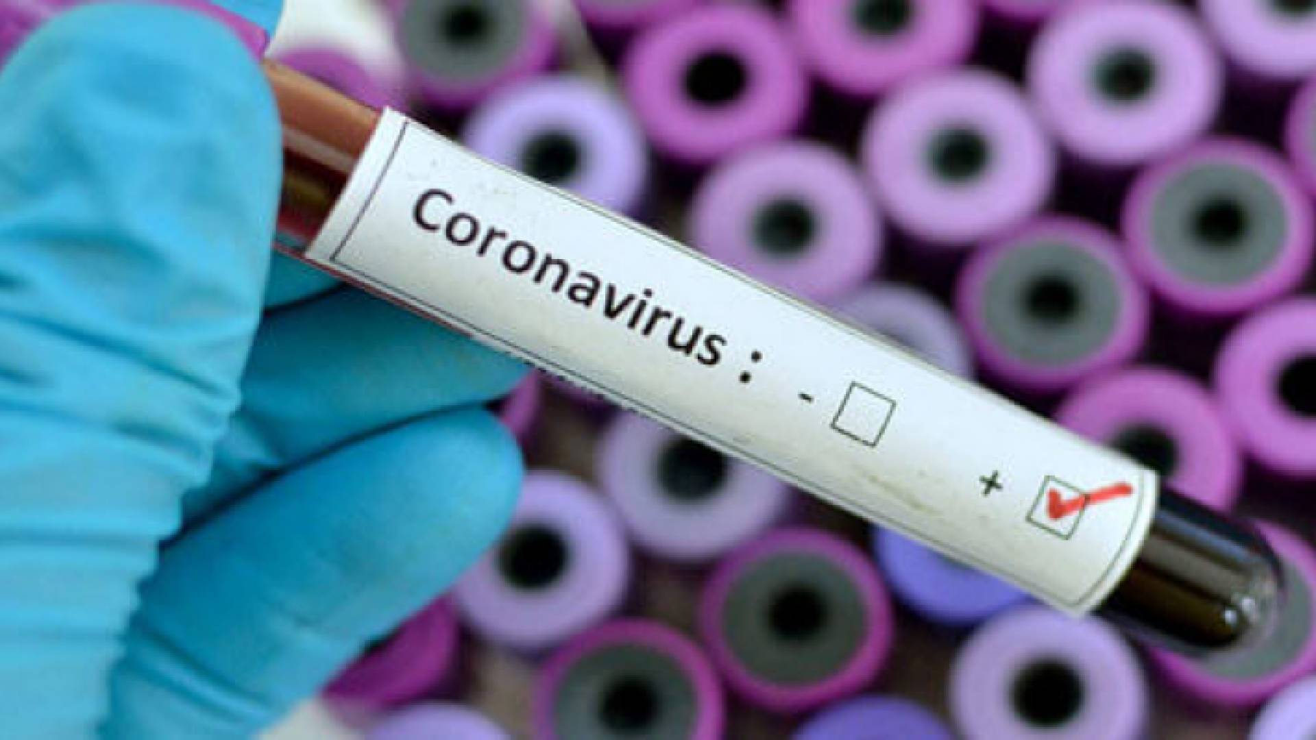 سجلت أعلى عدد وفيات بكورونا في الهند