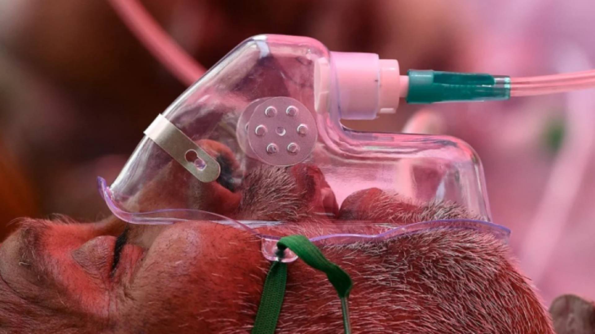 أطباء يكشفون عن العلاقة بين الفطر الأسود وفيروس كورونا