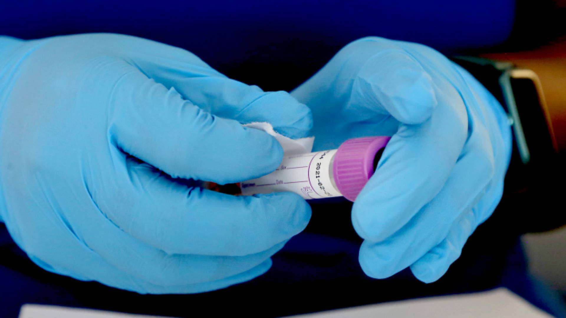 عينة فحوصات كورونا