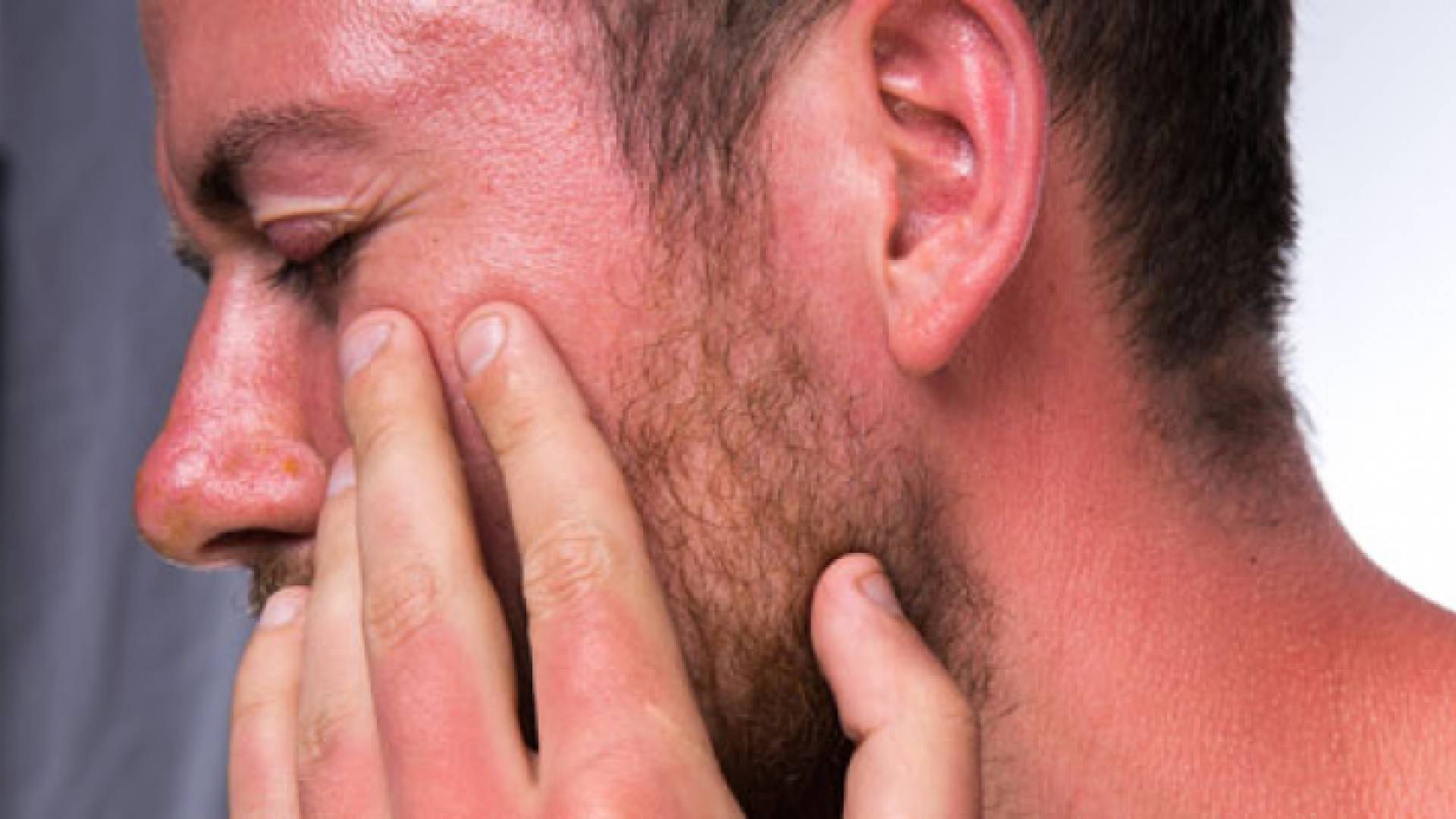 أمراض جلدية - تعبيرية