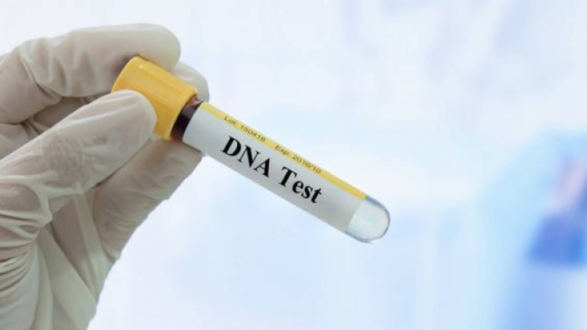 الصورة تعبيرية