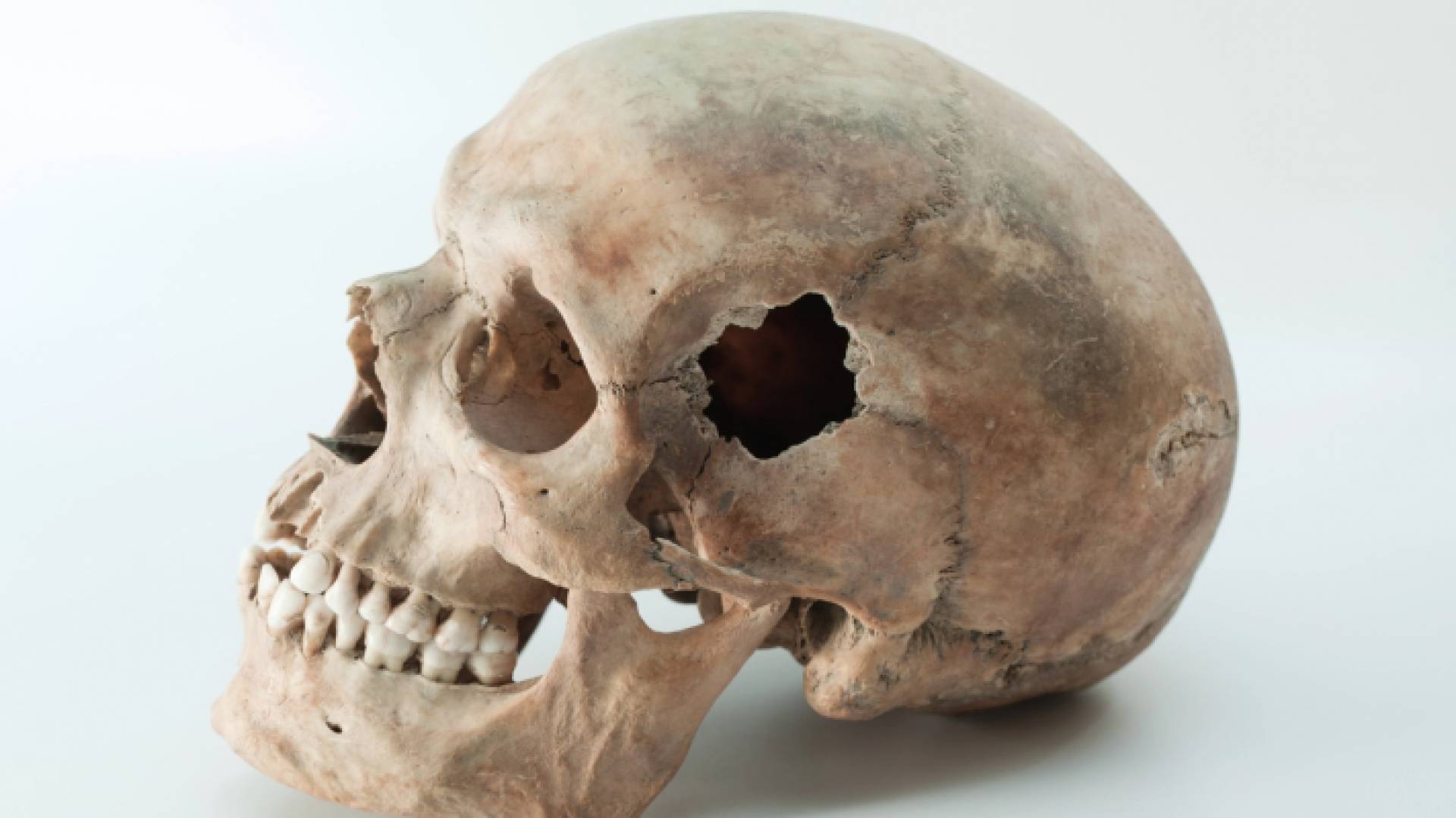 جمجمة بشرية - تعبيرية