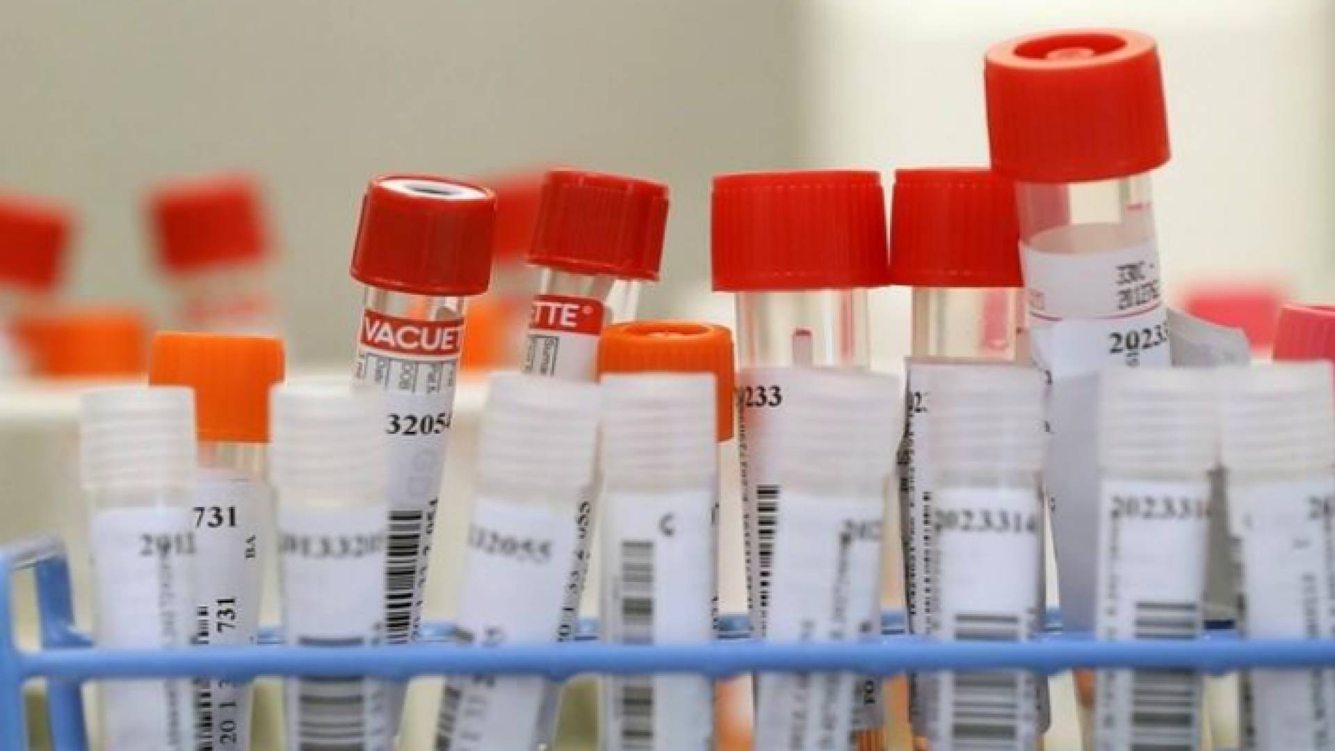 فحوصات كورونا - تعبيرية