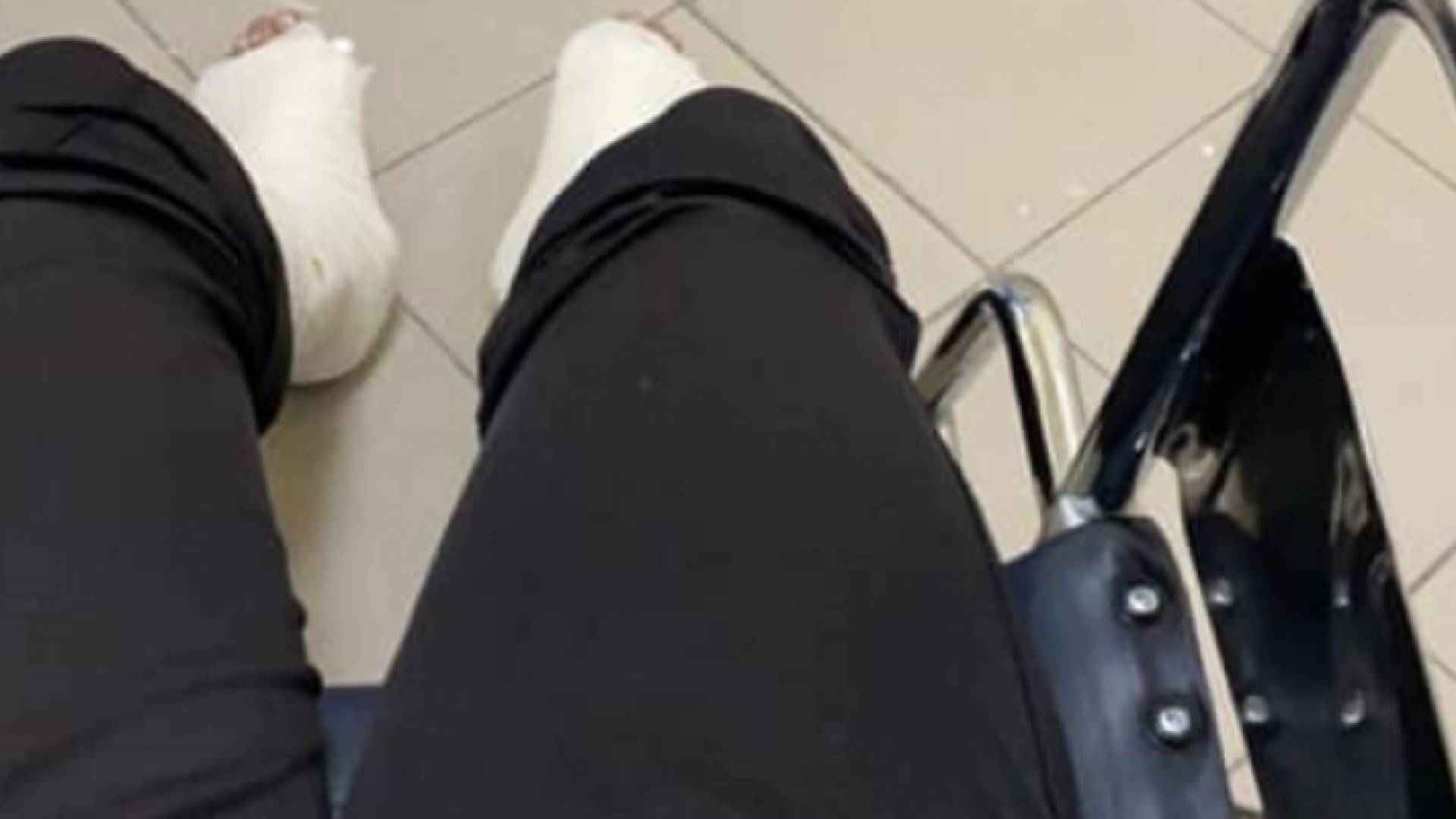 الكسر الذي تعرضت له الطالبة يارا الدميسي