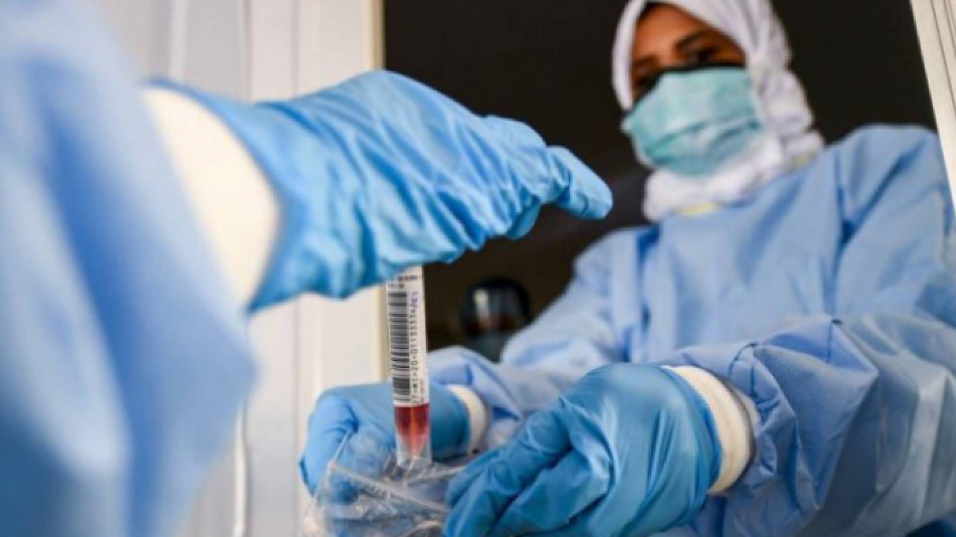 فرق التقصي الوبائي تقوم بأخذ عينات فحوصات بي سي آر