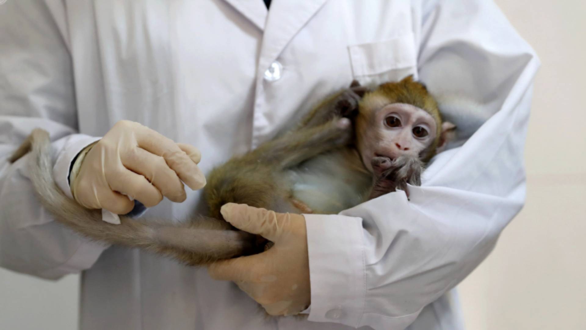 الصين تسجل أول إصابة بفيروس "هربس ب"