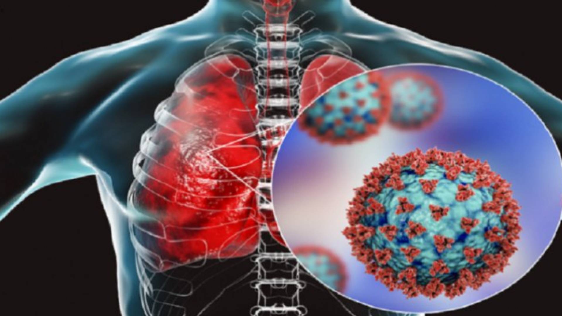 الفطر الأسود - تعبيرية