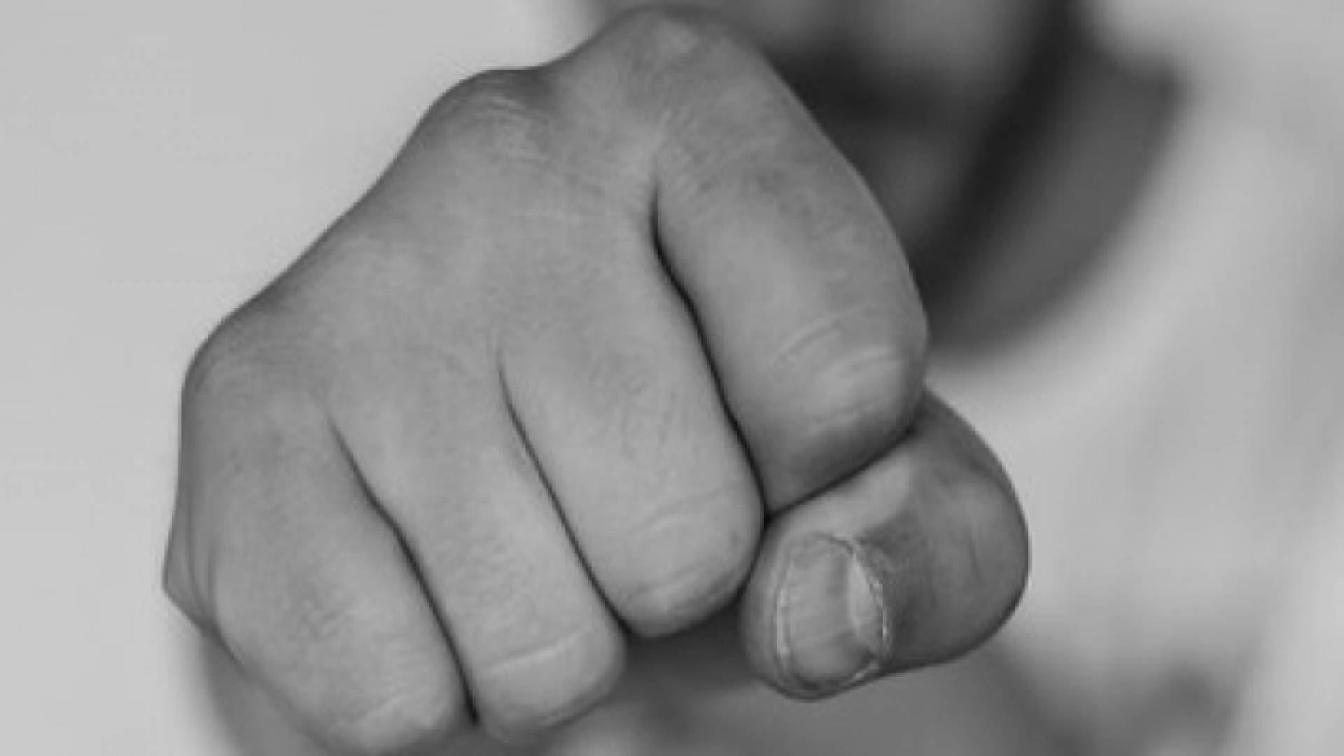 اعتداء بالضرب - تعبيرية