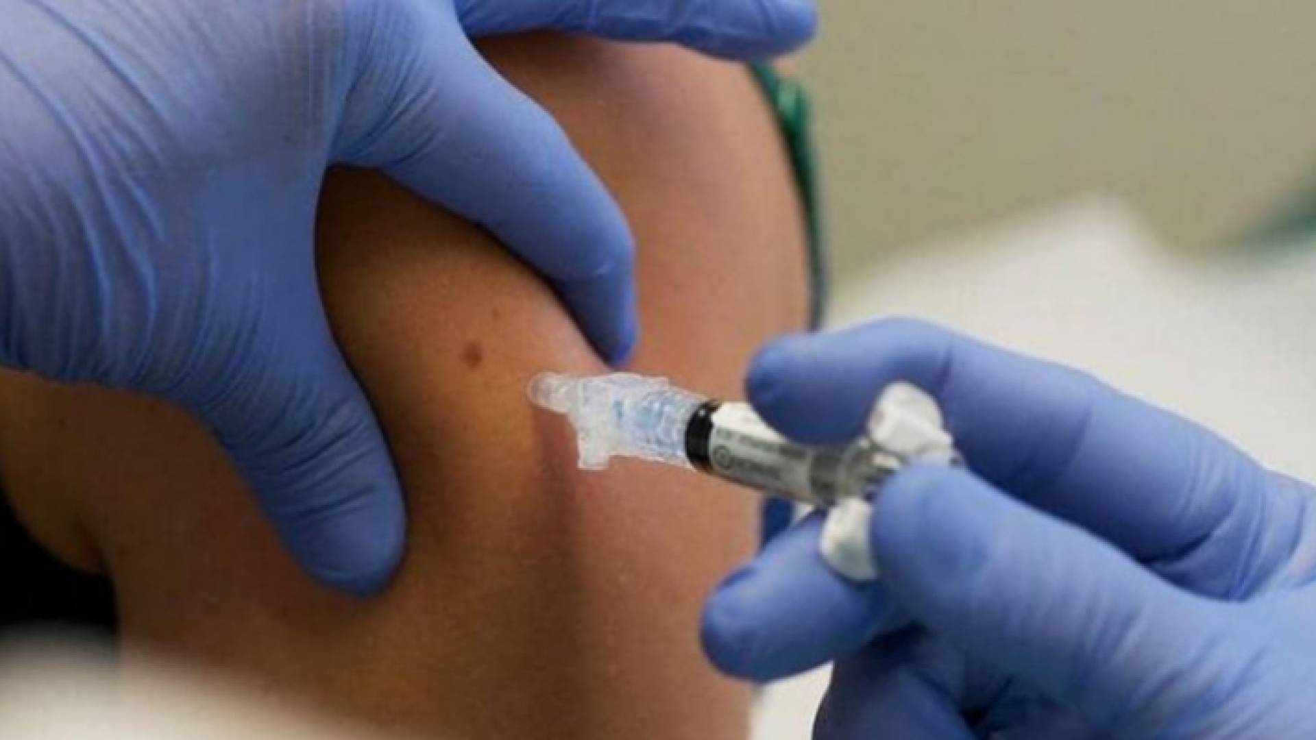 تطعيم أرشيفية