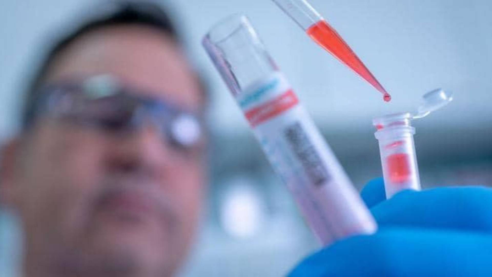 يتوقع أن يلعب اللقاح دورا خصوصا في البلدان النامية