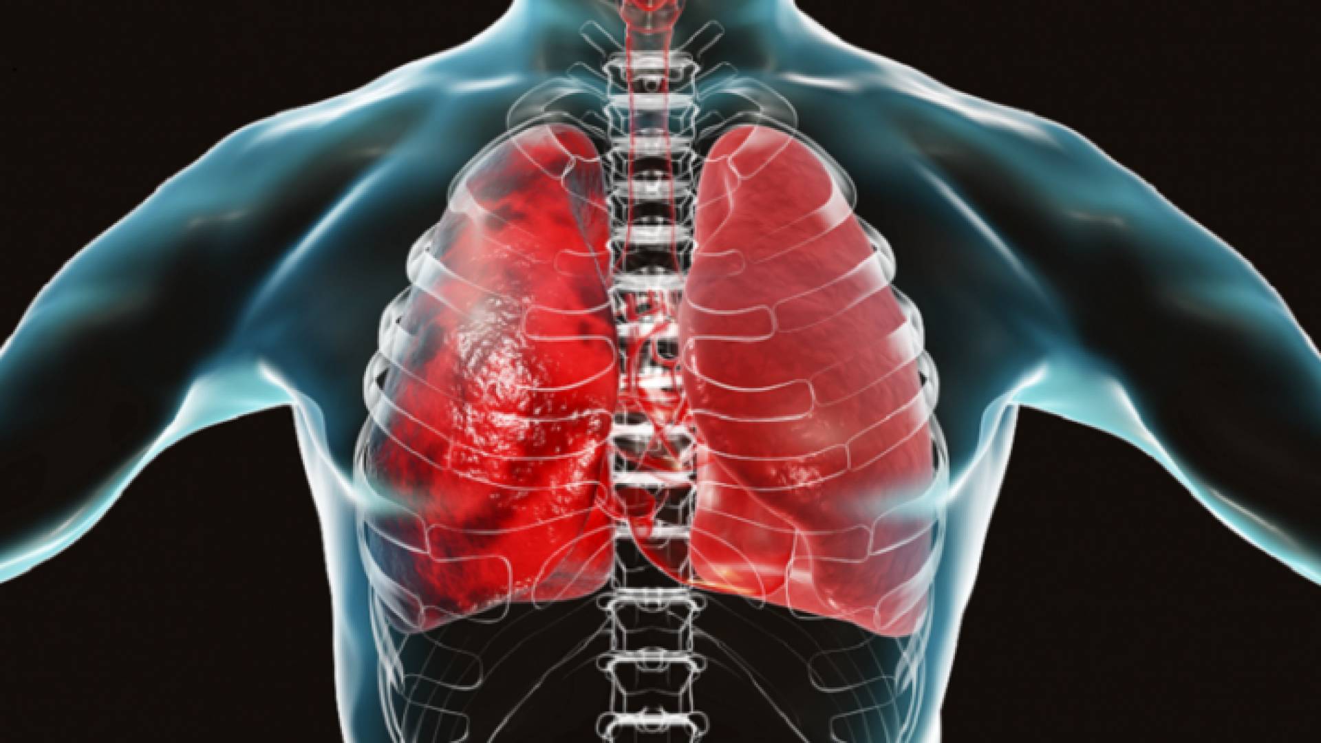 رئتين - تعبيرية