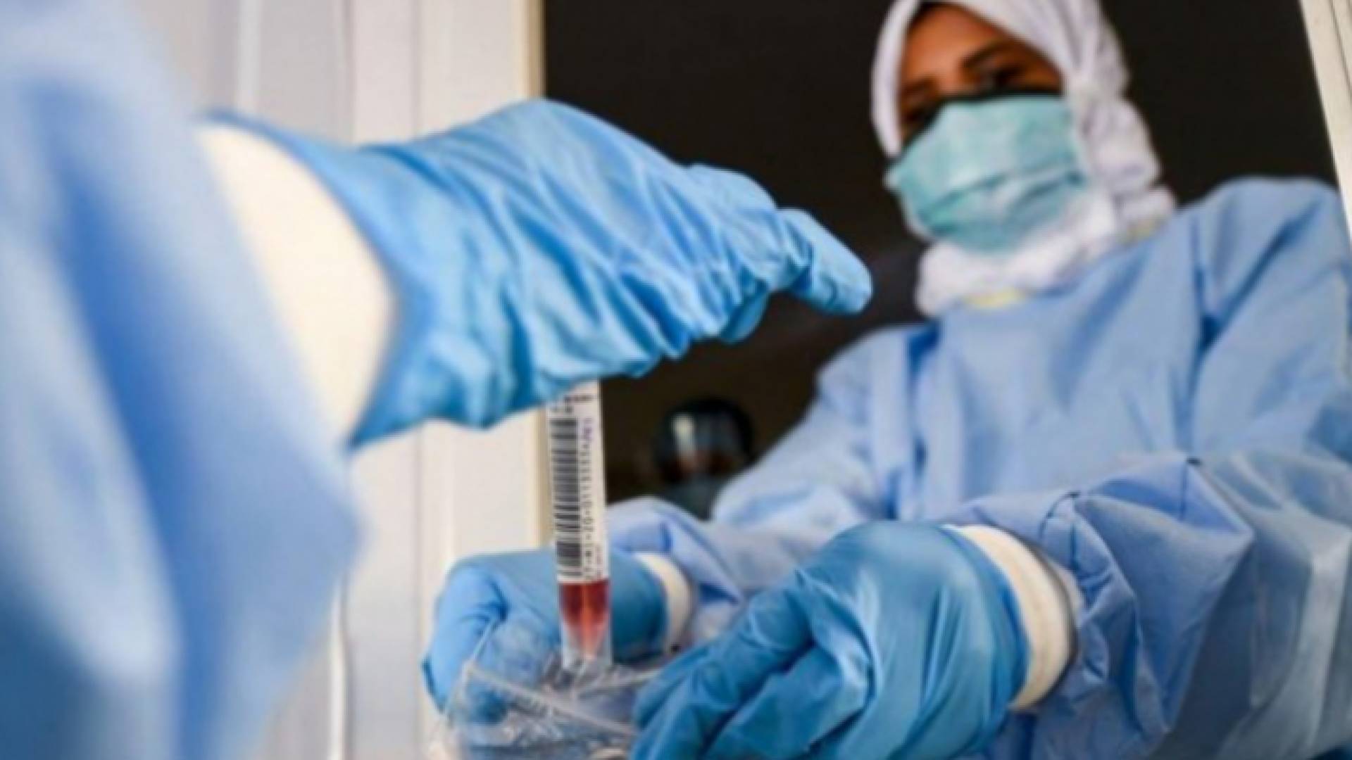 نسبة الفحوص الإيجابية لكورونا 4.21 بالمئة.. وانخفاض اعداد الإصابات