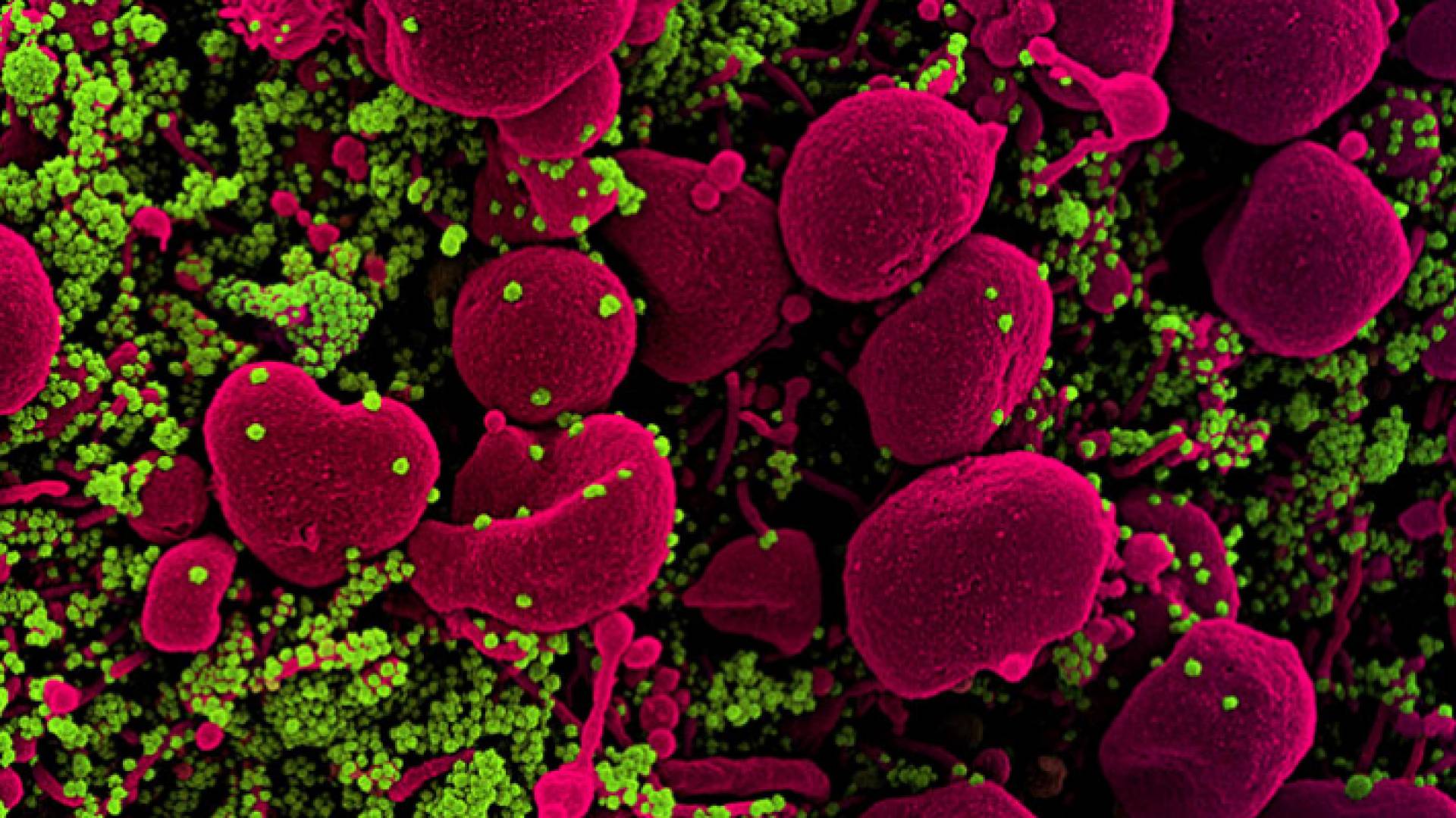 متحورات كورونا - تعبيرية