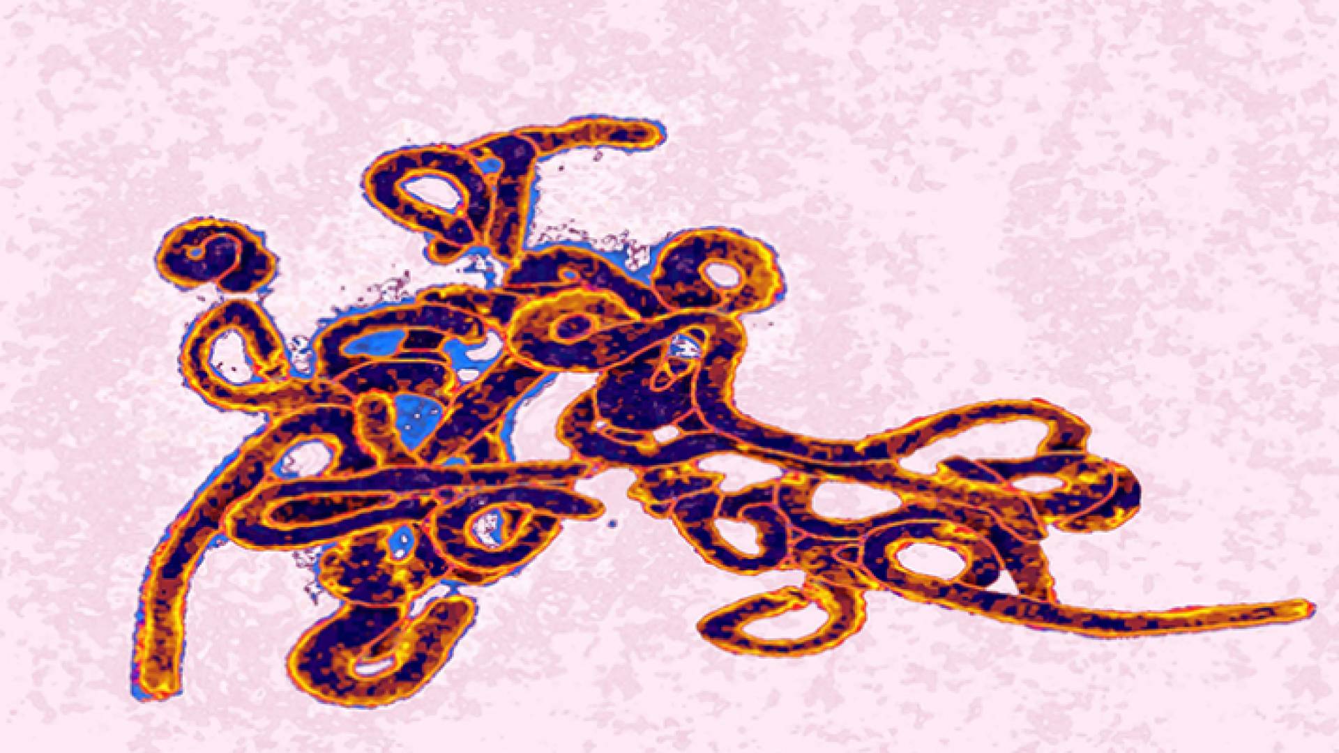 فيروس ايبولا - تعبيرية