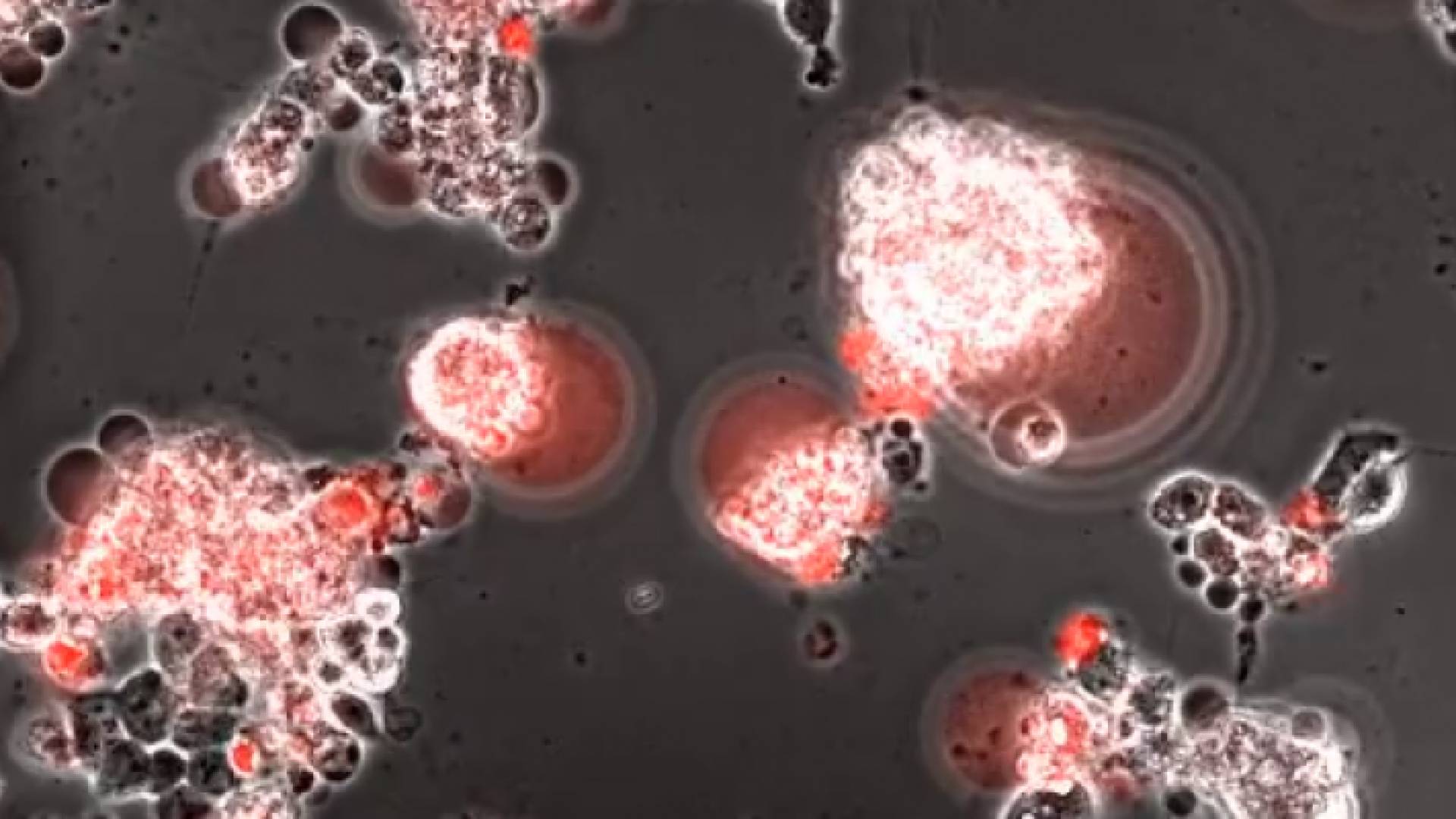 صورة من الفيديو تبيّن غزو فيروس كورونا خلايا الدماغ