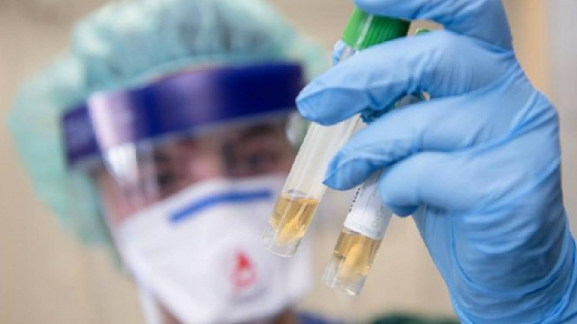 استمرار التطعيم ضد كورونا في مختلف دول العالم