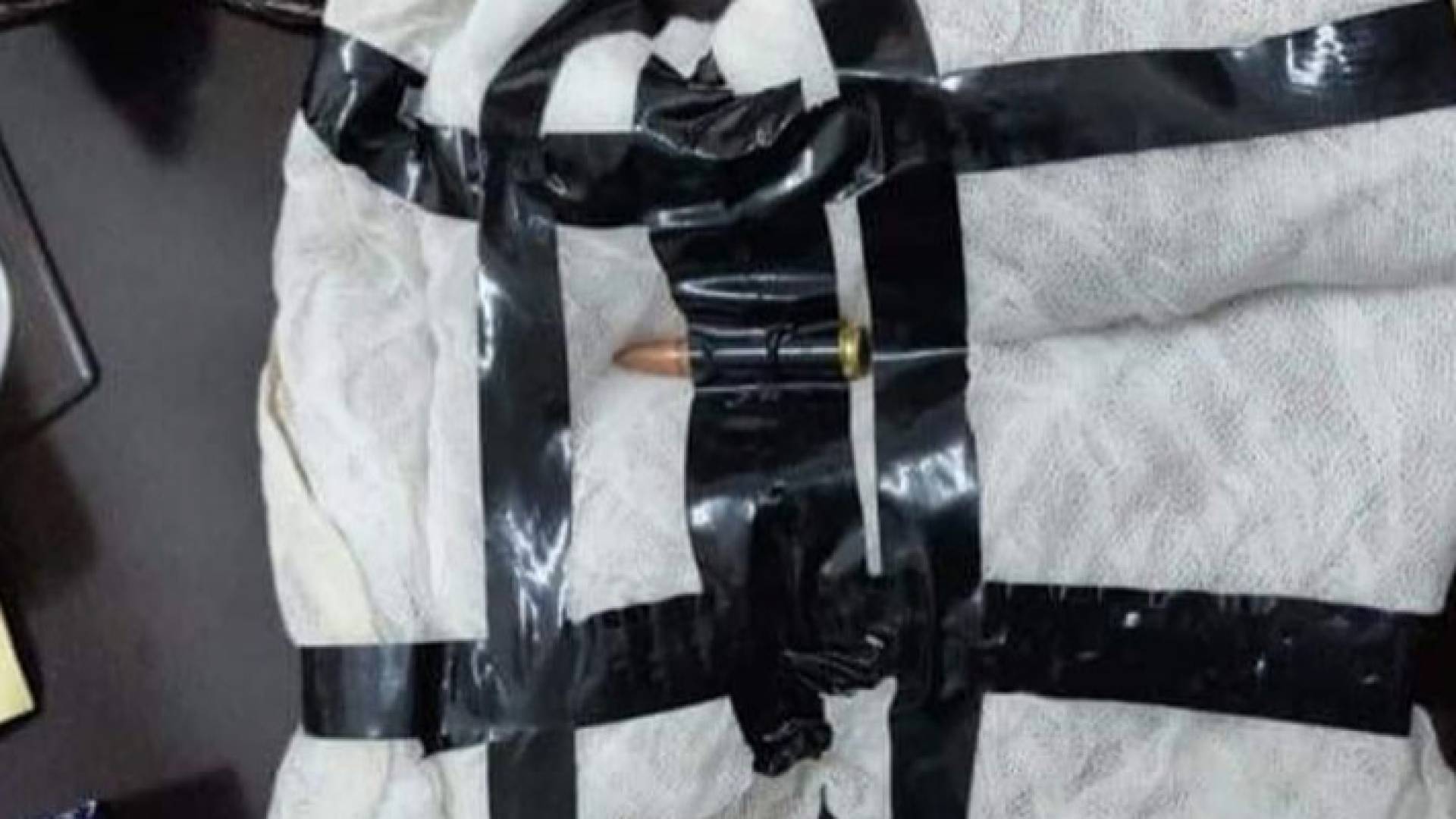 الرصاصة التي عثر عليها في المستشفى