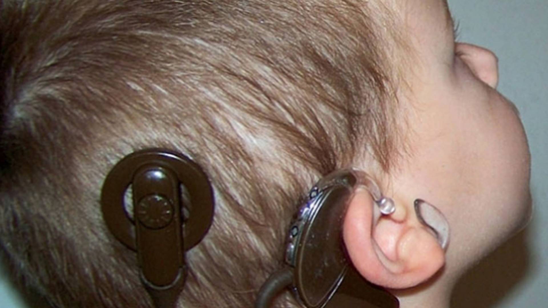 زراعة القوقعة