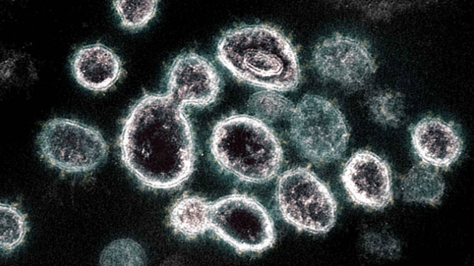 صورة مجهرية لفيروس كورونا