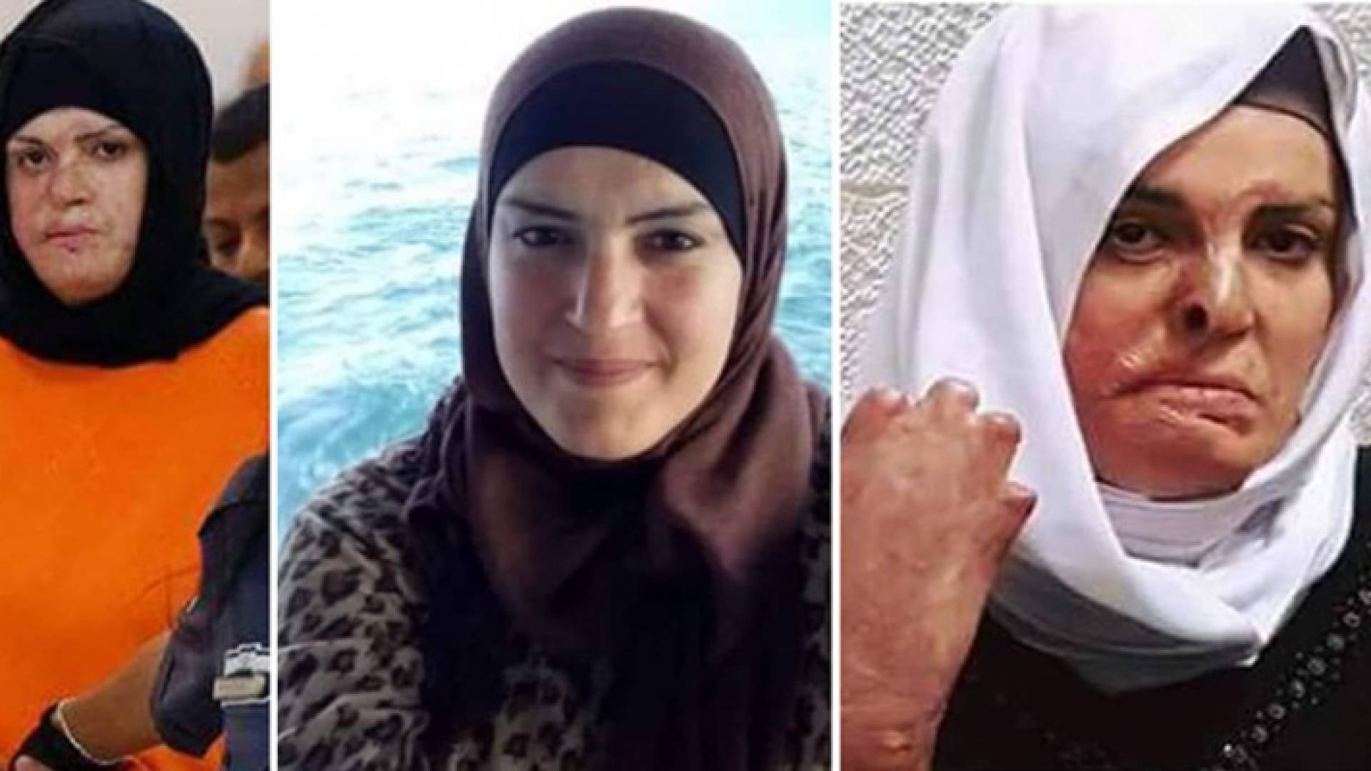 الأسيرة الفلسطينية إسراء جعابيص