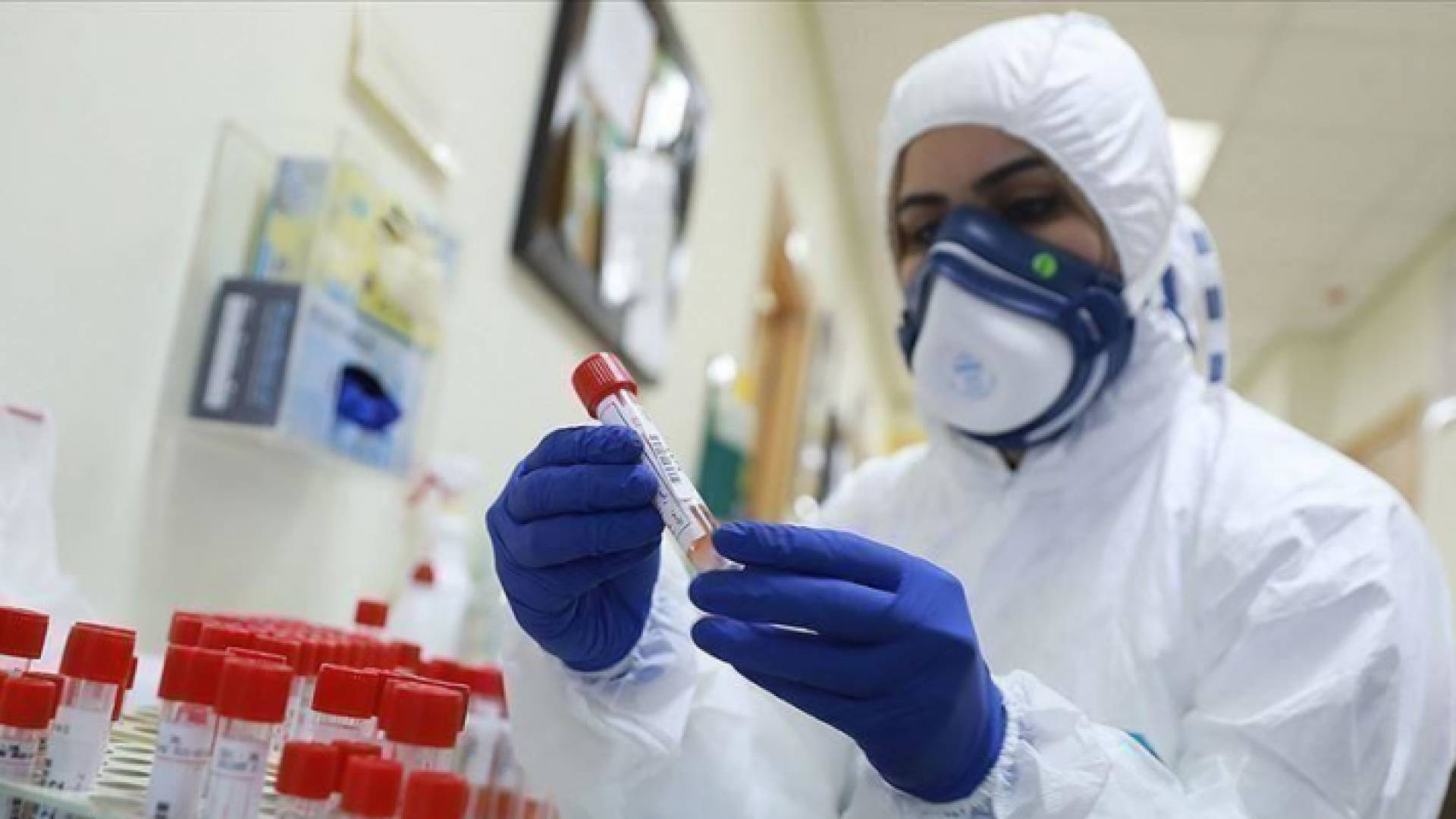 عينات فحص كورونا