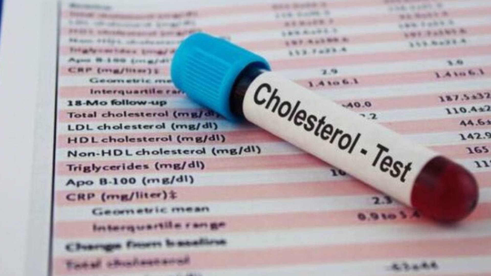 الكوليسترول لا يؤدي إلى ظهور أعراض خارجية في أغلب الأحيان