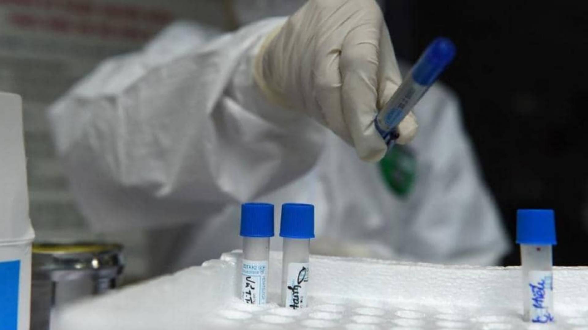 تحاليل طبية - ارشيفية