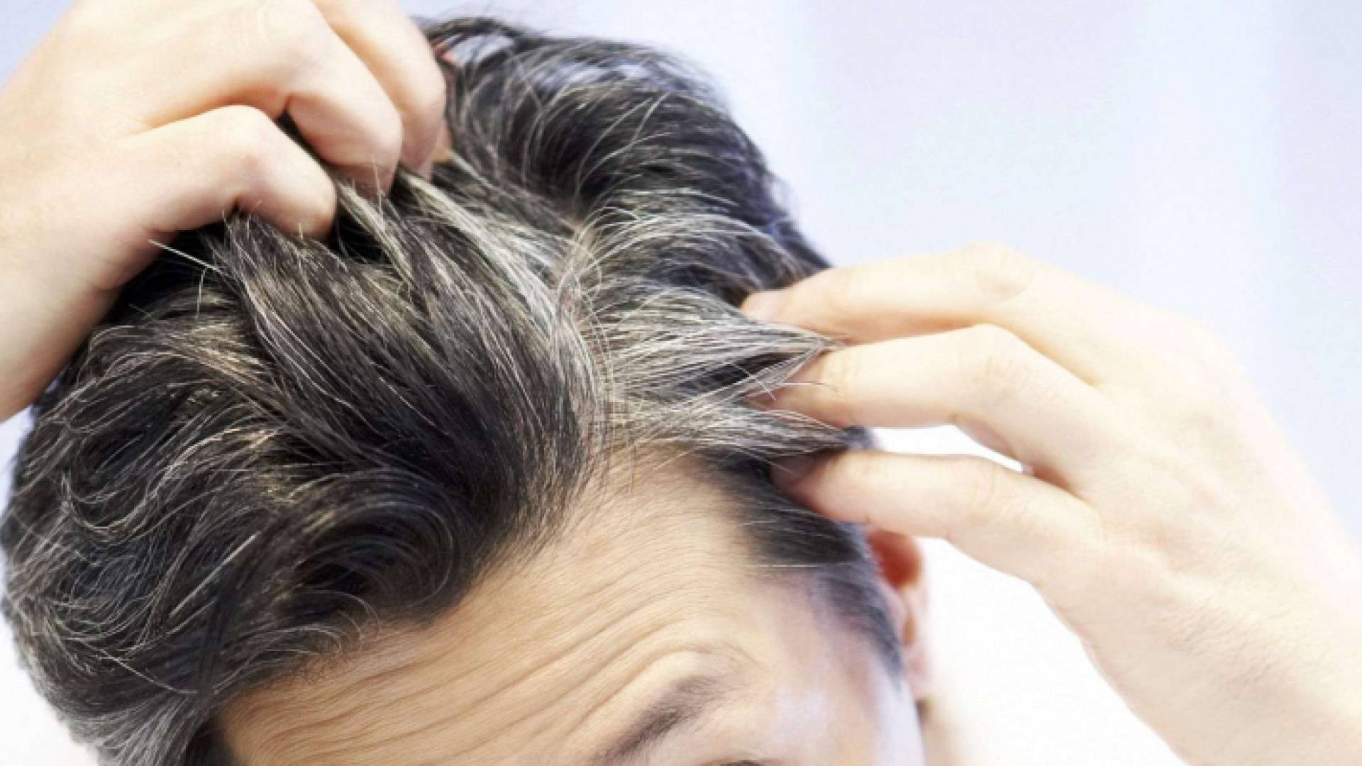 شاب تسلل الشيب المبكر إلى رأسه - تعبيرية