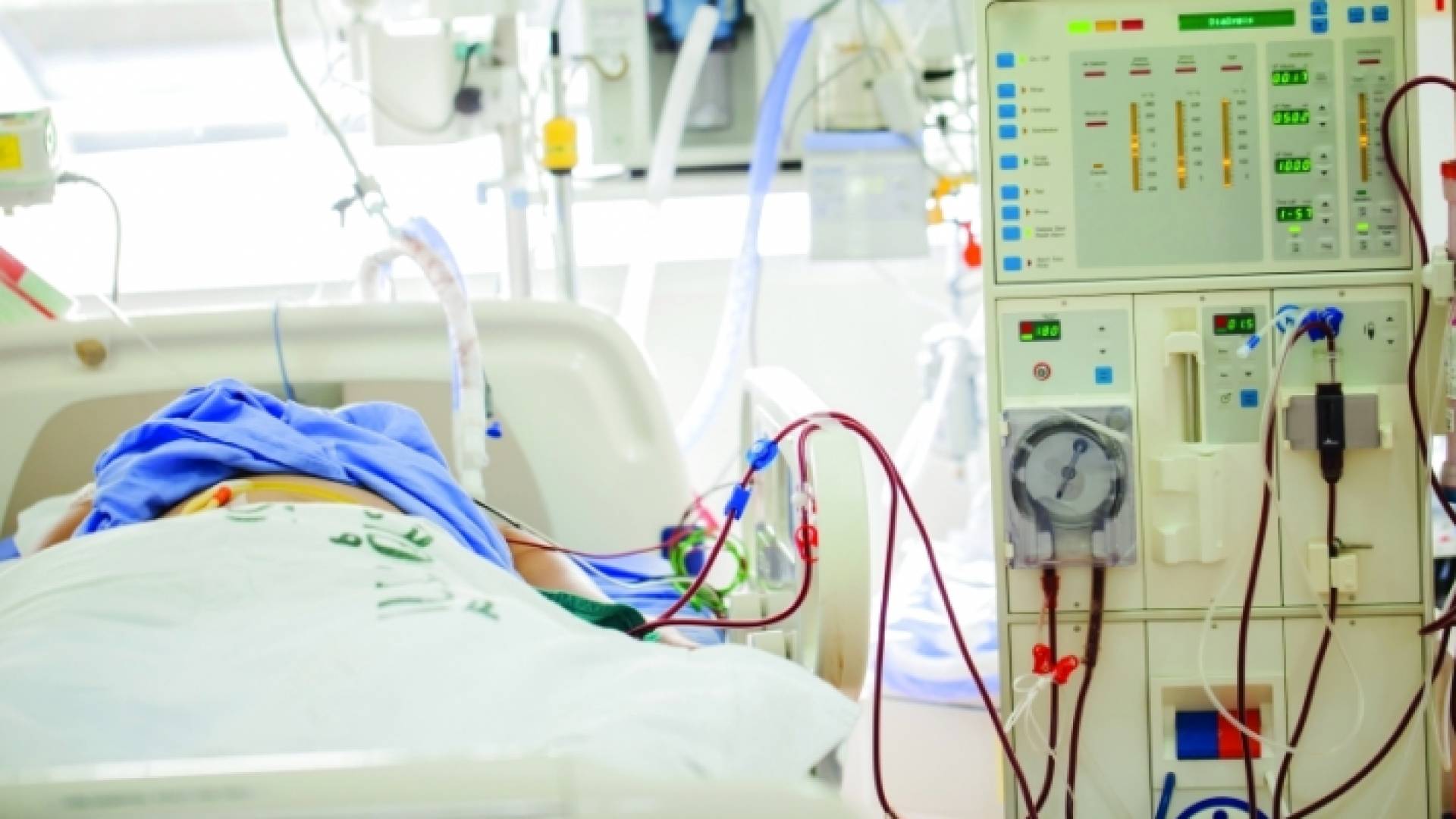 وحدة غسيل الكلى - ارشيفية